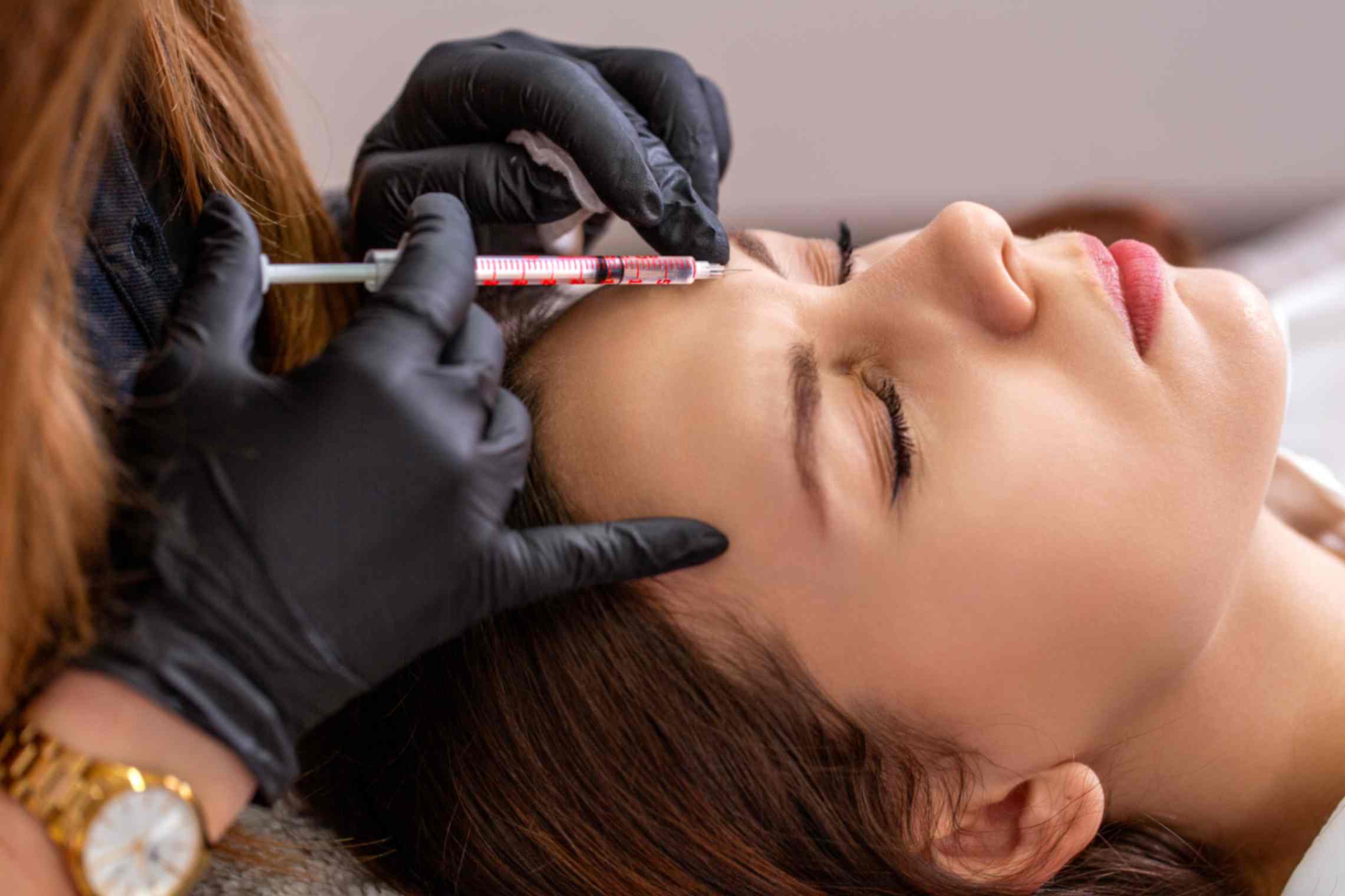 RHA Filler vs. Juvederm: RHA 2, RHA 3, and Juvederm for Lips