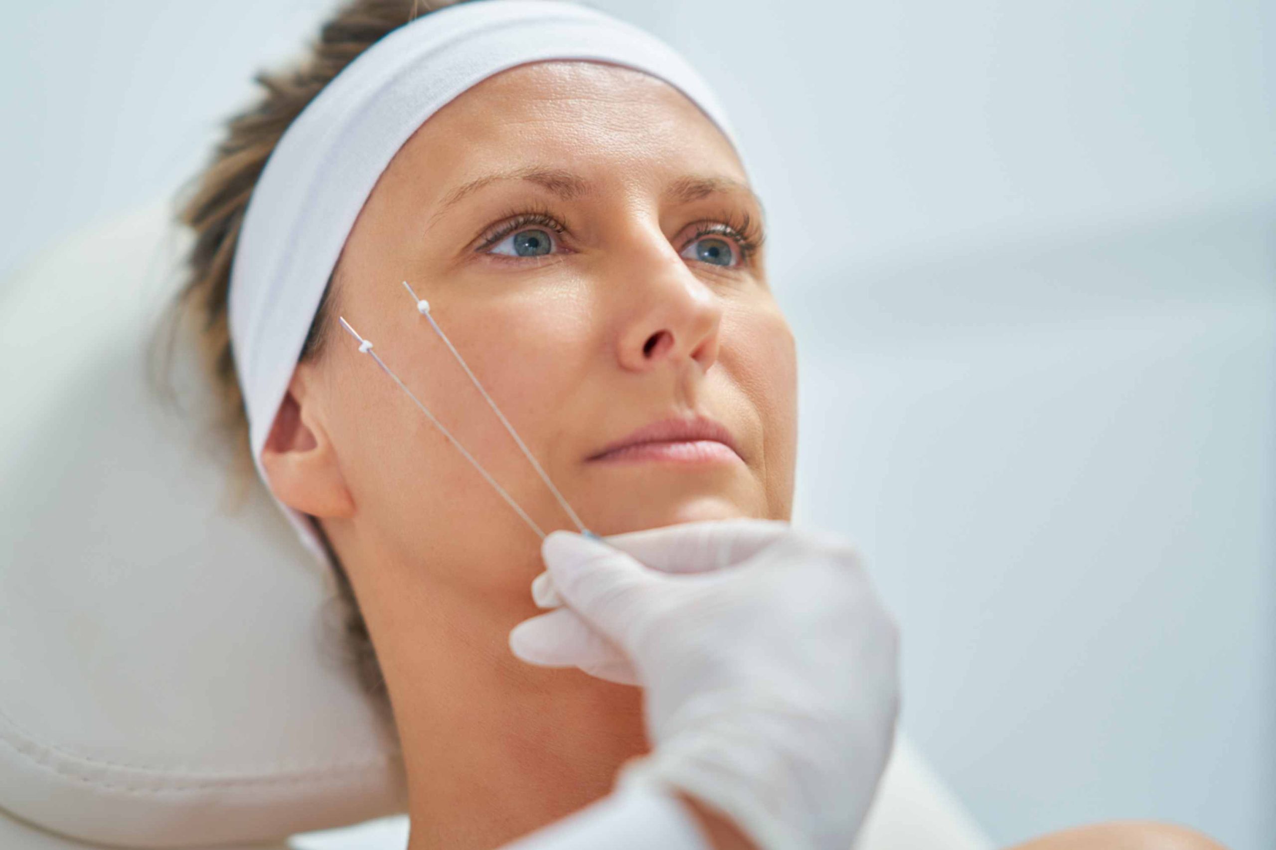 Disadvantages of Thread Lift vs. Side Effects
