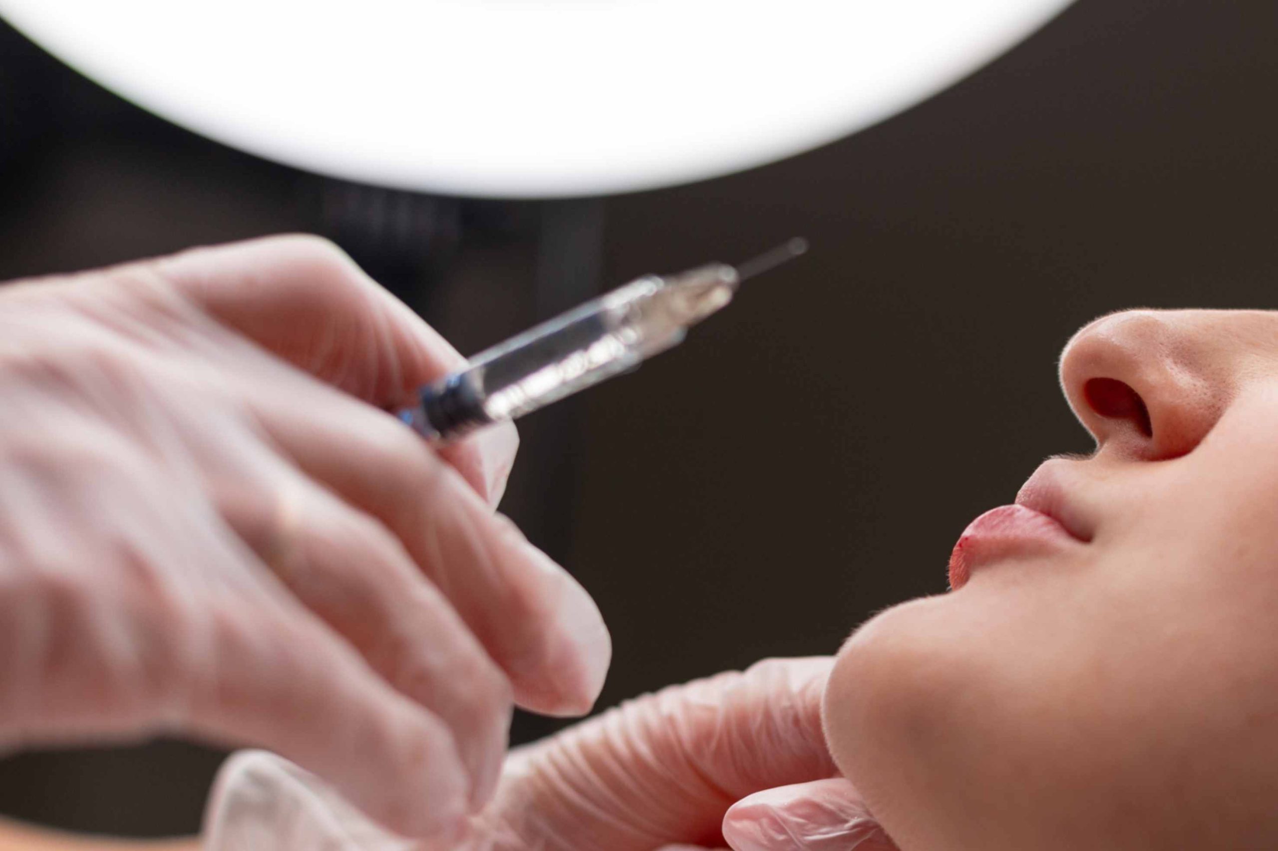 How Often Do You Have to Get Lip Fillers