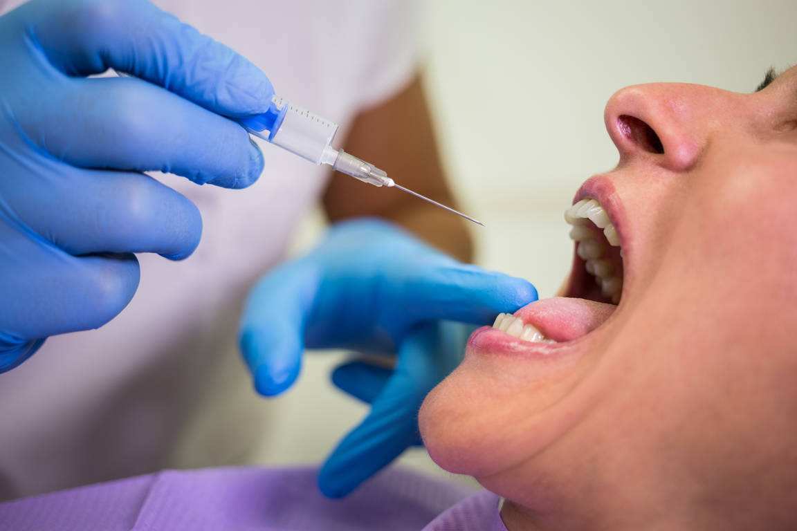 Dermal Fillers for Gums Before and After
