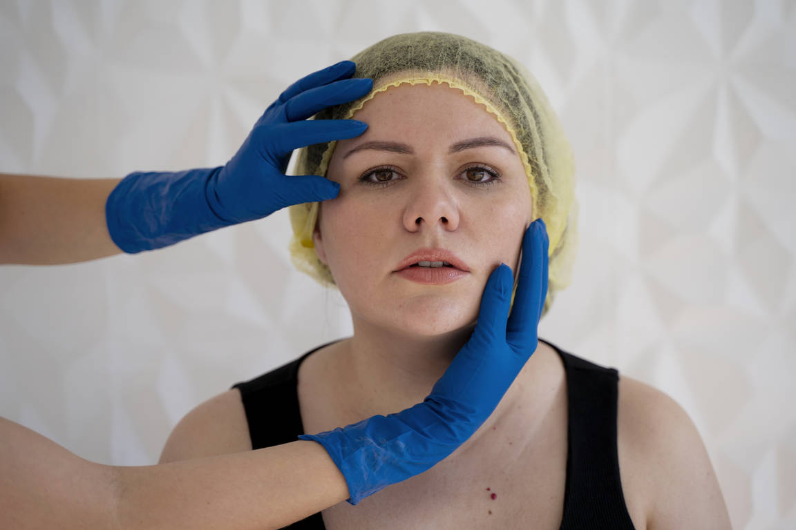 Filler Fatigue: How to Avoid the Overfilled Look 