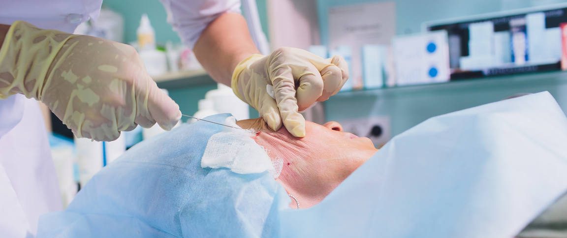 Do Warm Compresses Help PDO Thread Swelling