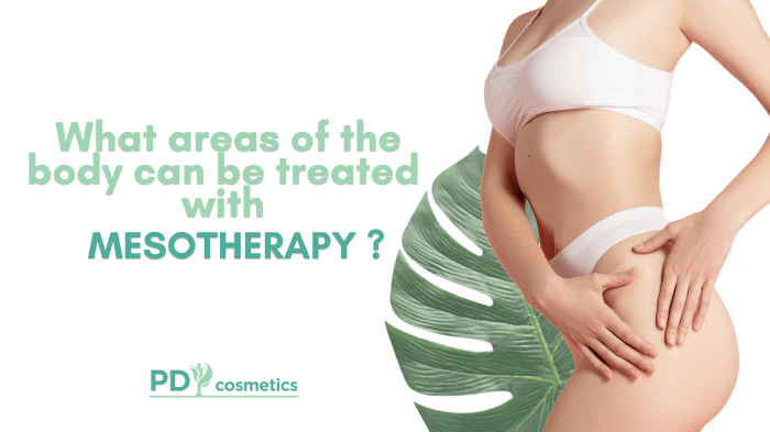 What Areas of the Body Can Be Treated with Mesotherapy