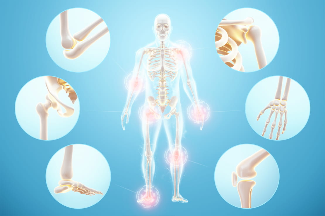 Rheumatoid Vs. Osteoarthritis. How Are They Different?