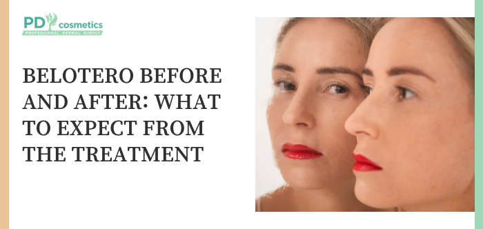 Belotero Before and After: What to Expect from the Treatment