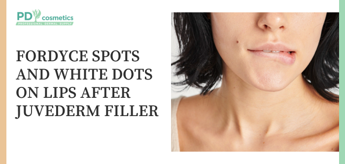 Fordyce Spots and White Dots on Lips After Juvederm Filler