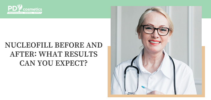 Nucleofill Before and After: What Results Can You Expect