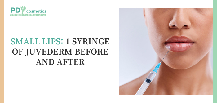 Small Lips: 1 Syringe of Juvederm Before and After
