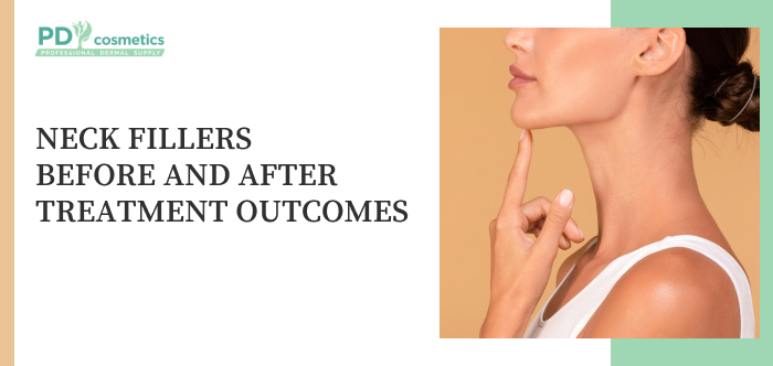 Neck Fillers Before and After Treatment Outcomes