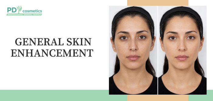 general skin enhancement